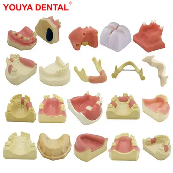 1 Adet Diş İmplant Modeli Eğitim Diş Modeli Diş Teknisyeni Uygulama Eğitim Diş Hekimliği Öğretim Ekran Diş Modelleri